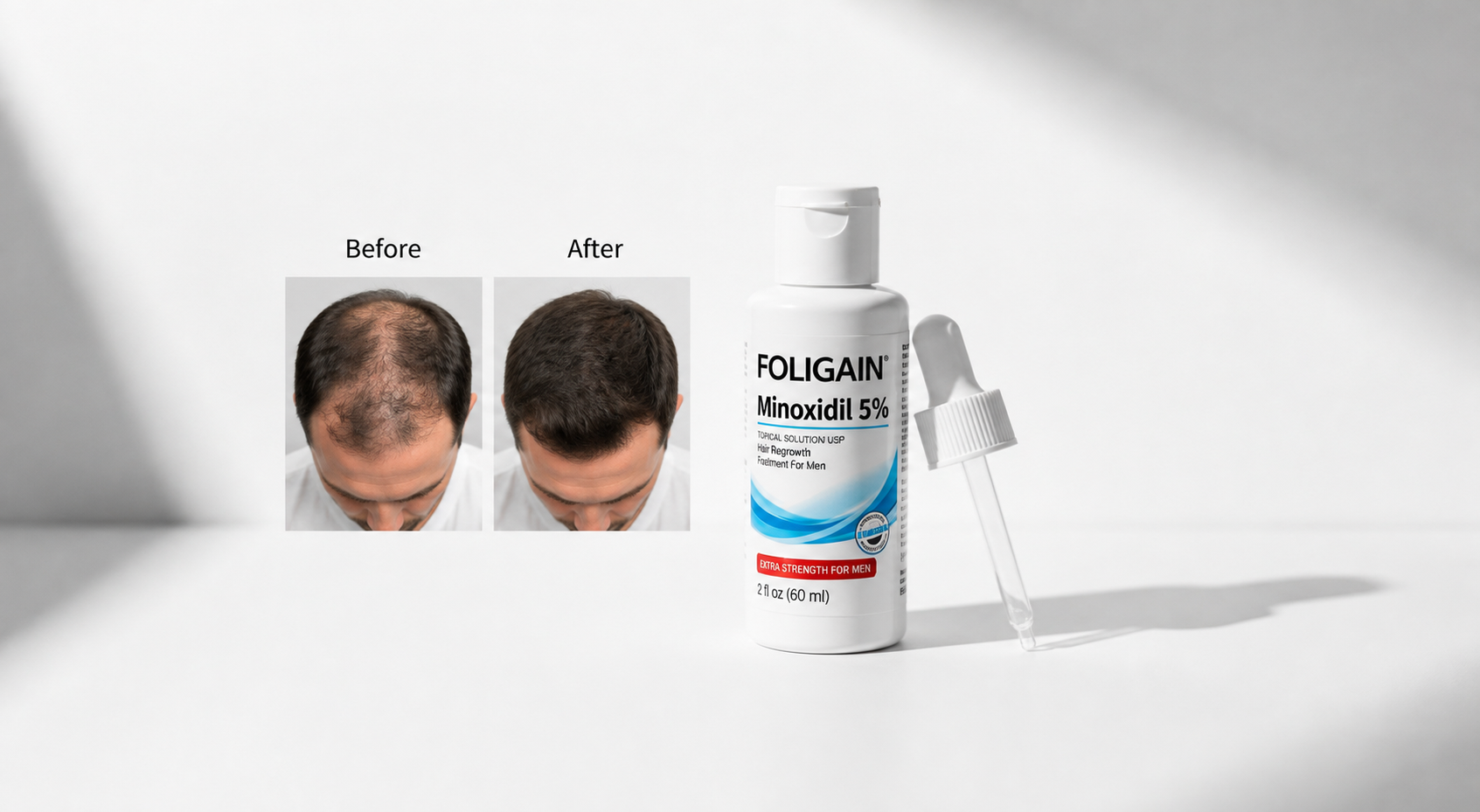 How to Apply Foligain Minoxidil 5% for Hair Regrowth